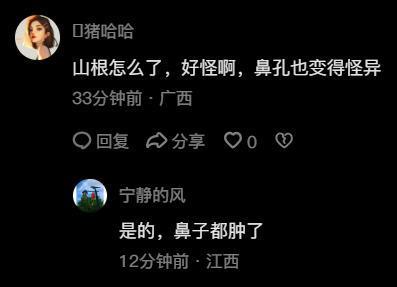 李湘带女儿游日本，山根肿胀鼻孔怪异，推26元按摩梳接地气