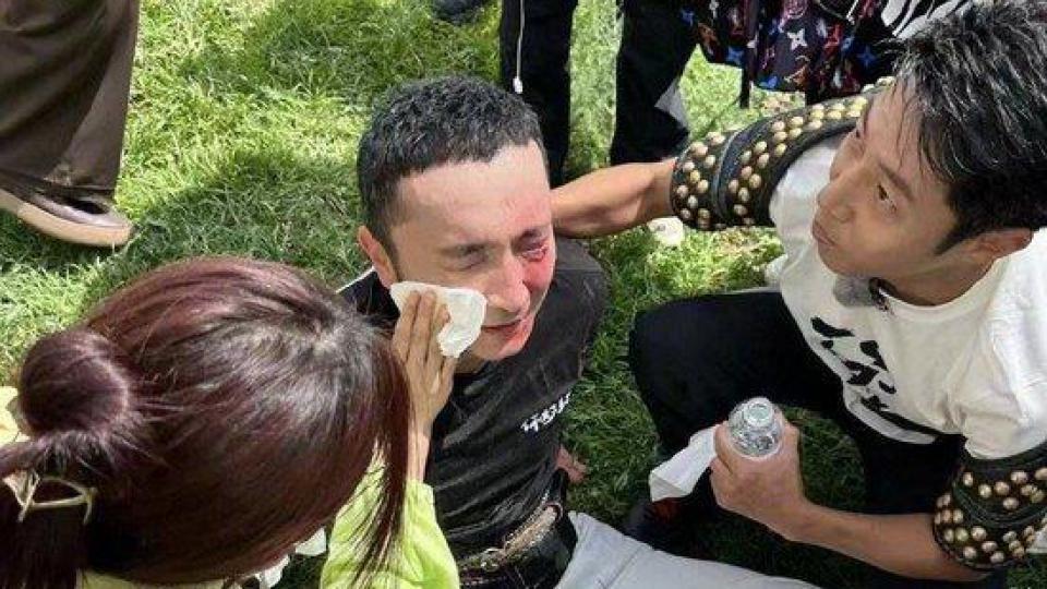 尼格买提录节目面部受伤 撒贝宁协助处理伤口