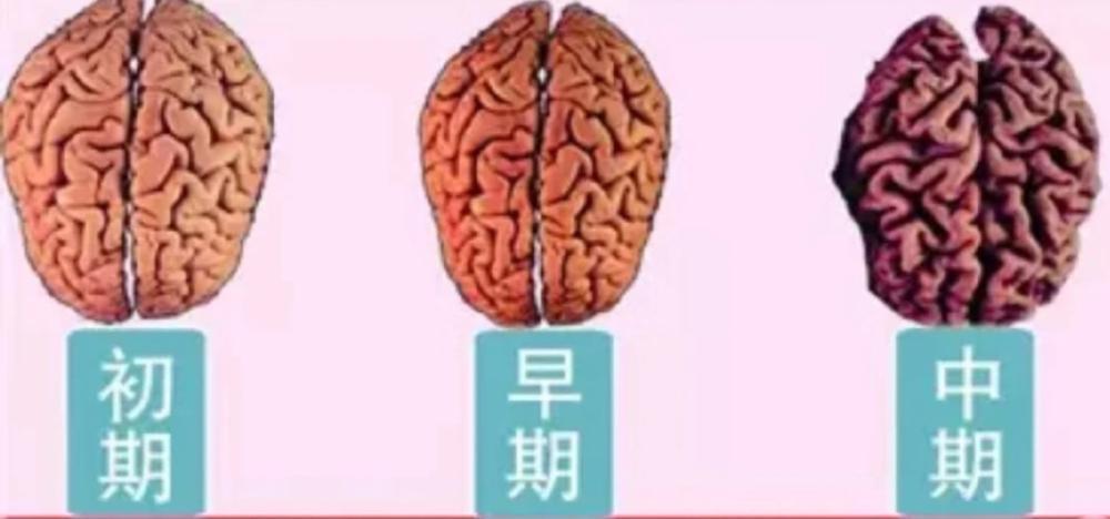 人类大脑相当于多少个GB的内存？