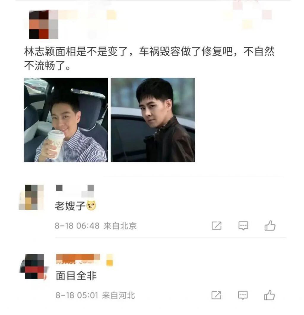 林志颖自曝车祸后遗症，网友：面目全非，太可惜了…
