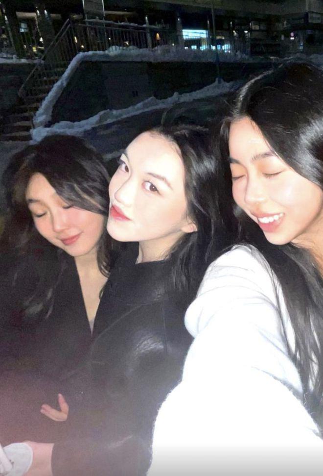 李亚鹏分享女儿唇腭裂治愈前画面，小李嫣超阳光