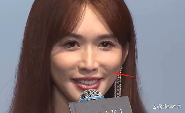 48岁林志玲最新状态曝光，脸僵苹果肌凸起，被嘲“蔡明化”