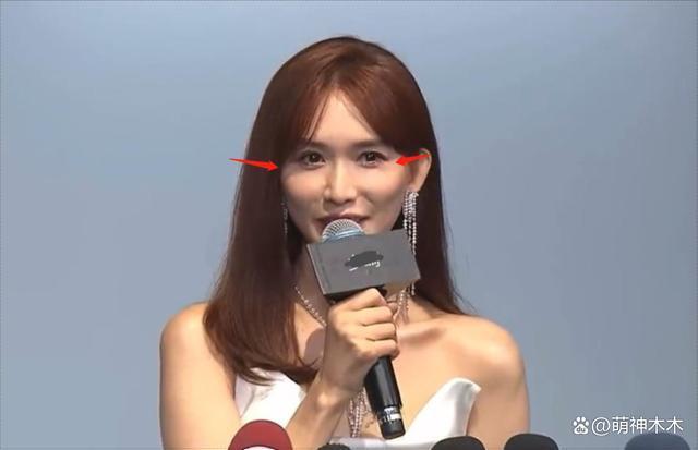 48岁林志玲最新状态曝光，脸僵苹果肌凸起，被嘲“蔡明化”