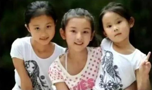 童年女神嫁富豪，脸肿成发面馒头