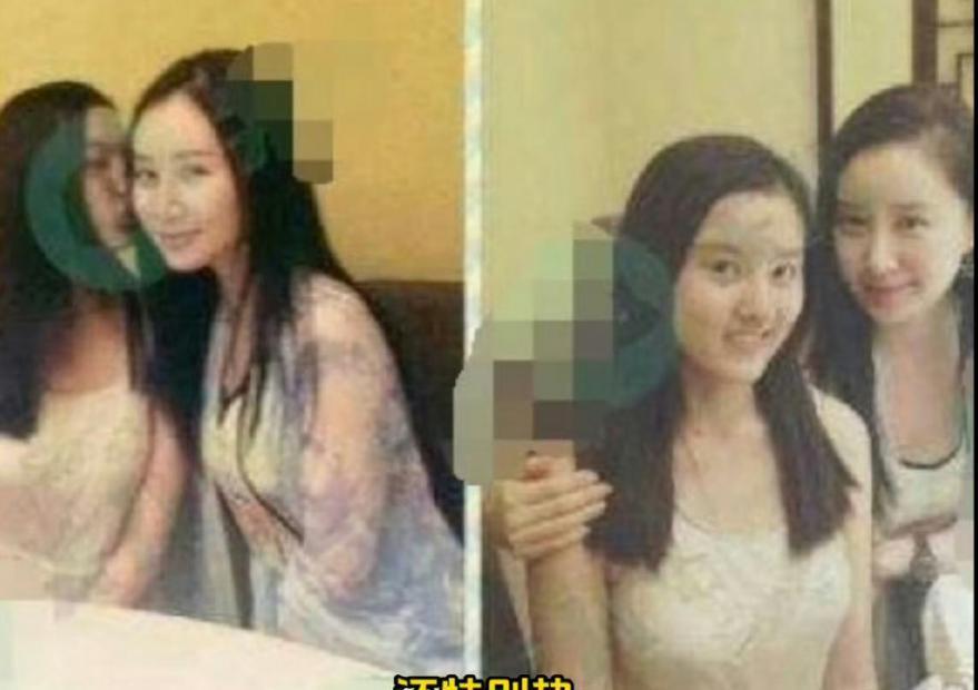 童年女神嫁富豪，脸肿成发面馒头