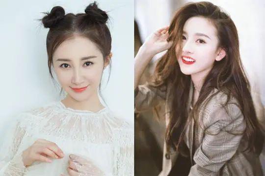 童年女神嫁富豪，脸肿成发面馒头