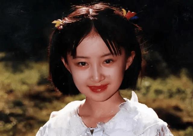童年女神嫁富豪，脸肿成发面馒头