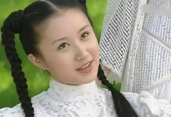 童年女神嫁富豪，脸肿成发面馒头