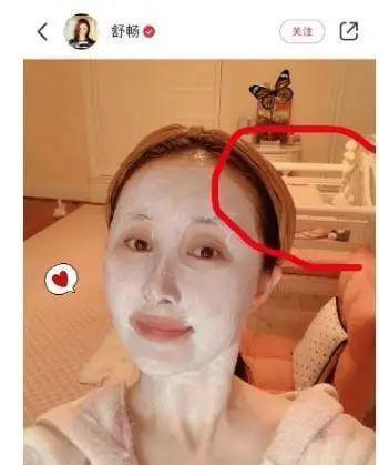 童年女神嫁富豪，脸肿成发面馒头