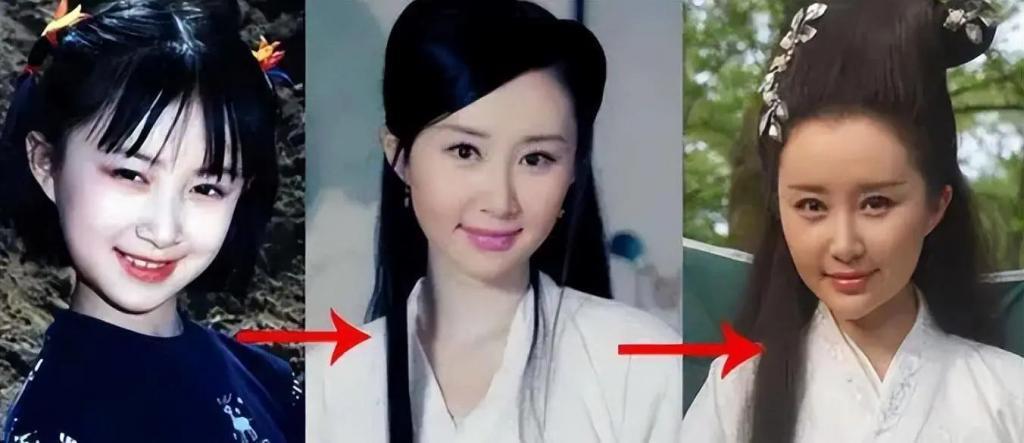 童年女神嫁富豪，脸肿成发面馒头