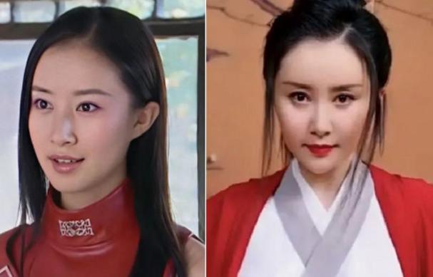 童年女神嫁富豪，脸肿成发面馒头