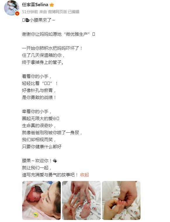 任家萱官宣生子，自曝因烧伤孕期水肿厉害