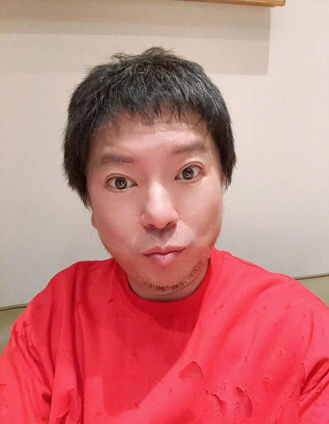 高晓松暴瘦认不出！剪短发瓜子脸似华晨宇，被疑做医美想复出