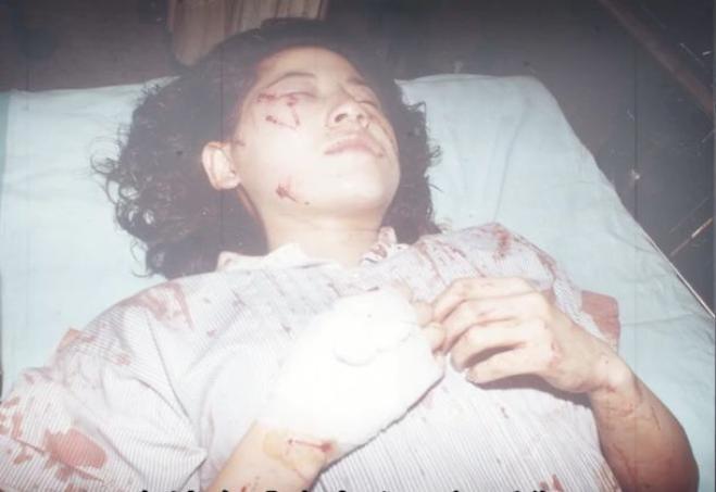 嫁当红小生被家暴毁容，获上亿保险金，人间蒸发？