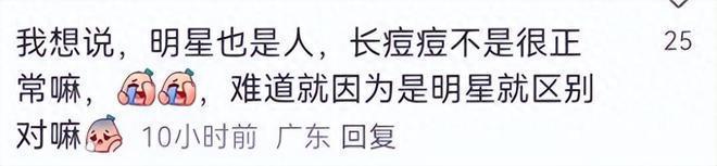 22岁王源米兰探店 脸上坑坑洼洼生图精修图差别大