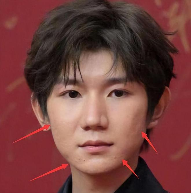 22岁王源米兰探店 脸上坑坑洼洼生图精修图差别大