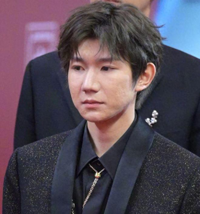 22岁王源米兰探店 脸上坑坑洼洼生图精修图差别大