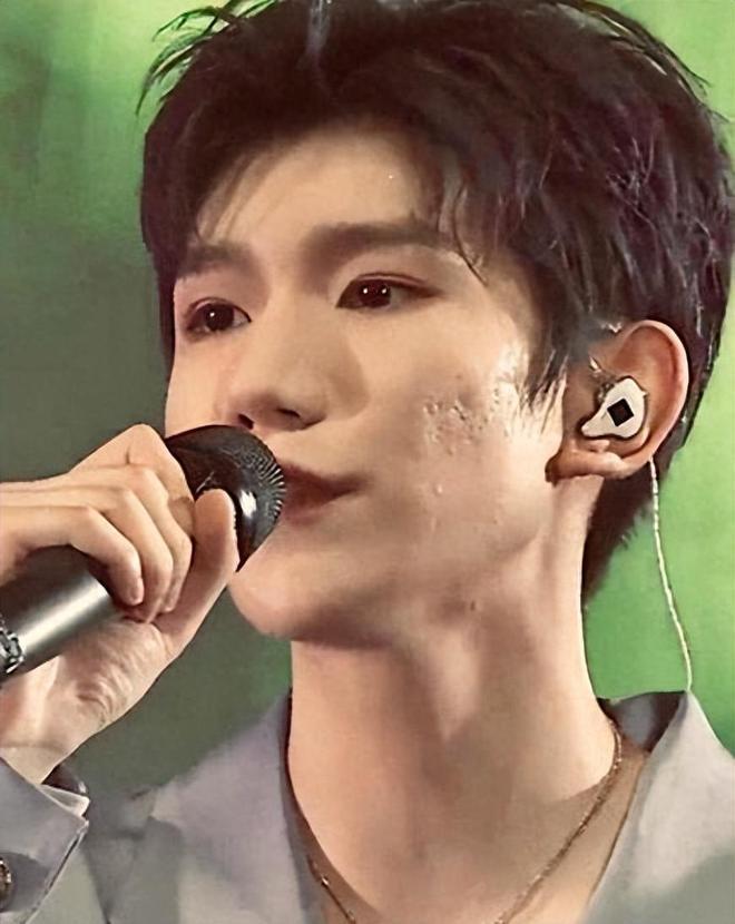 22岁王源米兰探店 脸上坑坑洼洼生图精修图差别大