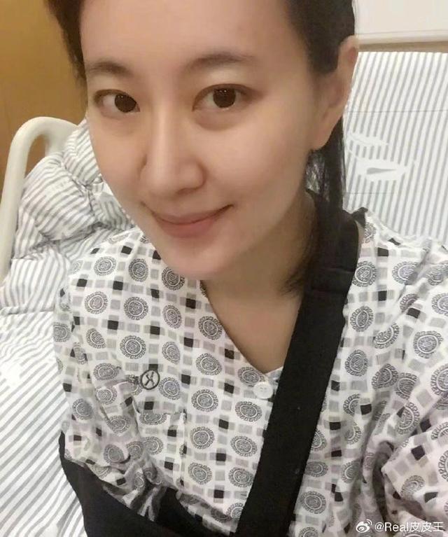 王乐君发文称《伪装者》拍摄期间被胡歌砸断了锁骨