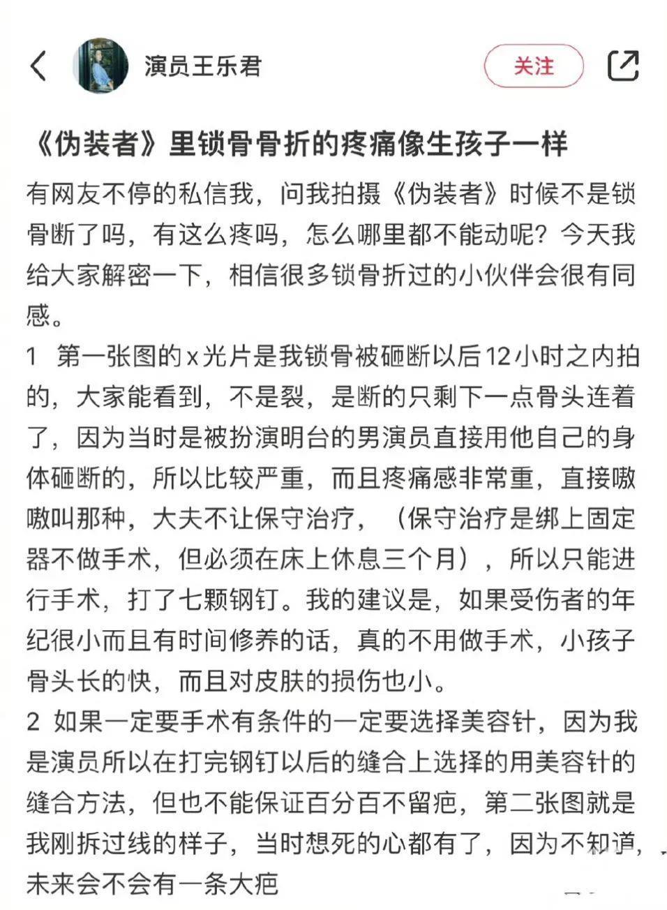 王乐君放飞自我，再谈片场受伤与粉丝互怼 ，难题到胡歌这边
