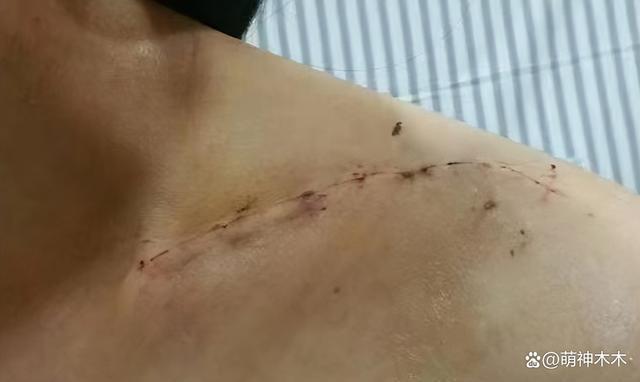 《伪装者》女主开撕胡歌！被撞断锁骨不让说，难忍被网暴十年