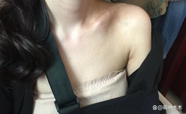 《伪装者》女主开撕胡歌！被撞断锁骨不让说，难忍被网暴十年