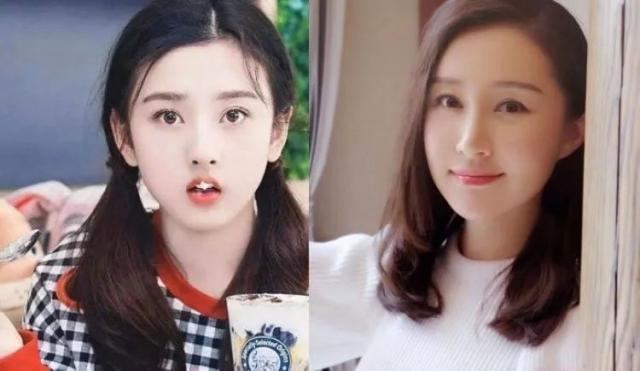 童年女神嫁富豪，脸肿成发面馒头