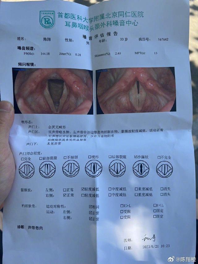 陈翔自曝声带息肉需做手术 新歌已写好等待嗓子恢复
