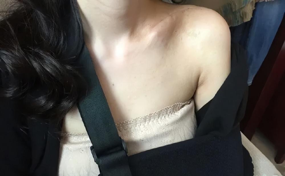 八年后《伪装者》女主发文,再提被胡歌砸伤事件,是有意还是无心