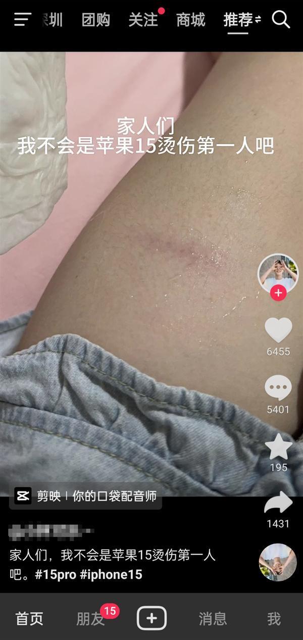 iPhone 15发热严重 有人称被烫伤!老用户喊话:前几代也很热 苹果通病