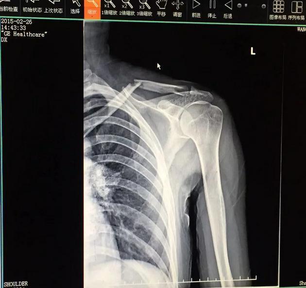 啥情况！揭露剧组黑幕，她被害惨了？