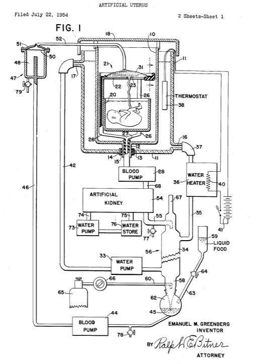 有望进入人体试验，人造子宫离我们还有多远？