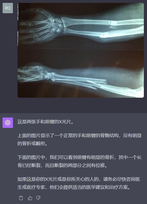 语音陪聊还能给你看病，升级后的ChatGPT又开始嘎嘎乱杀了。