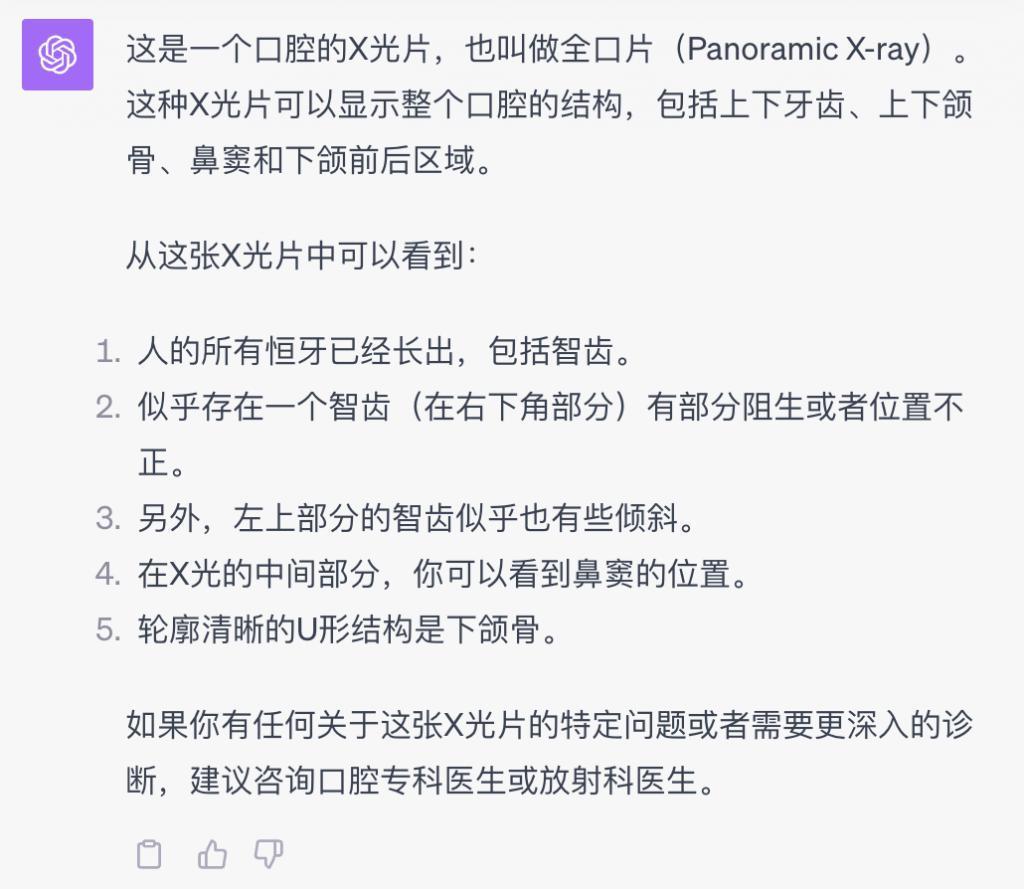 语音陪聊还能给你看病，升级后的ChatGPT又开始嘎嘎乱杀了。