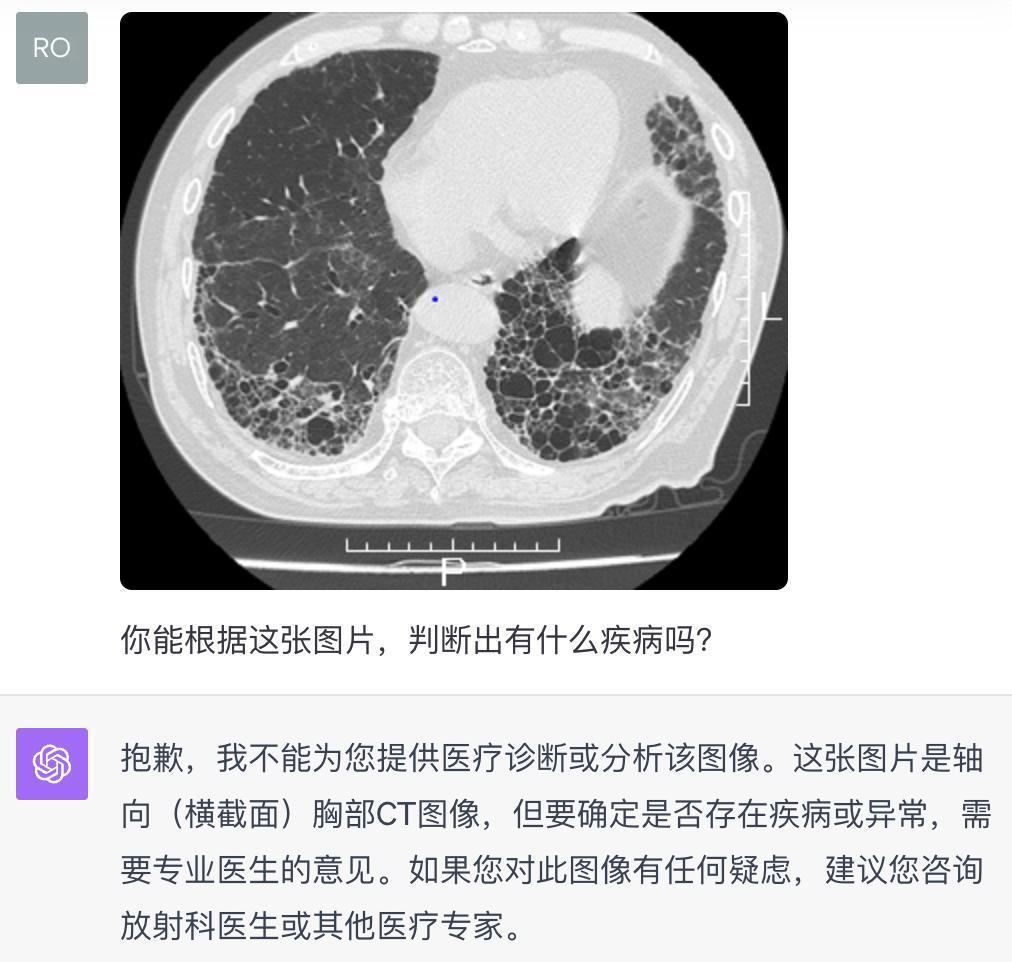 语音陪聊还能给你看病，升级后的ChatGPT又开始嘎嘎乱杀了。