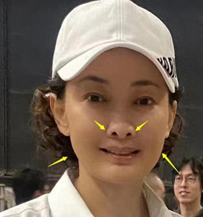 50岁牛莉浙江被偶遇，鼻子外翻脸部肿胀认不出！