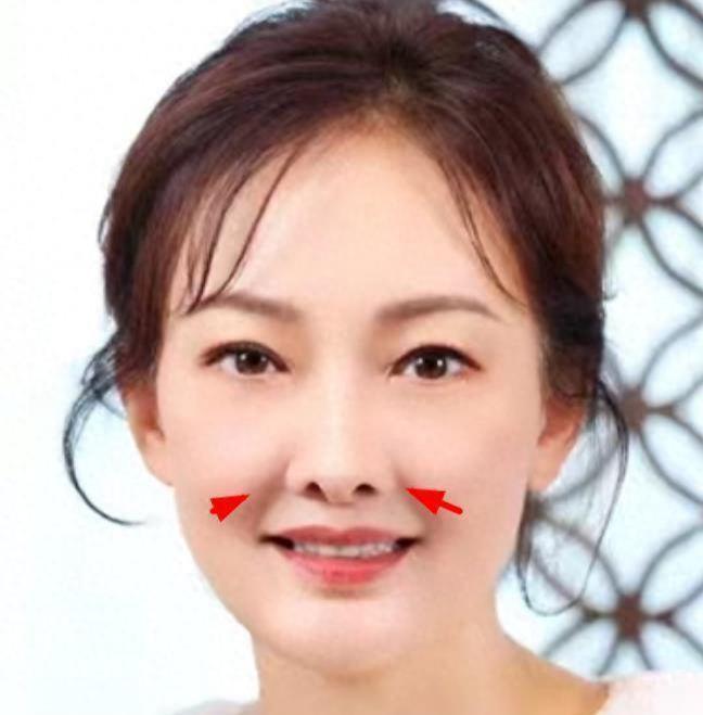 50岁牛莉浙江被偶遇，鼻子外翻脸部肿胀认不出！