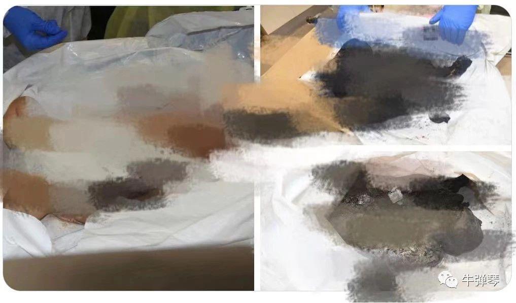 巴以冲突第六天，最触目惊心的图片出现了