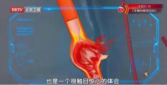 太突然!年仅42岁,知名男演员去世,已在老家安葬!这病很凶险