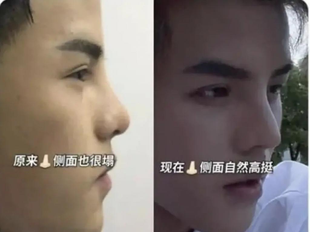 好久不见殷世航了？出国留学深造后续怎么样？