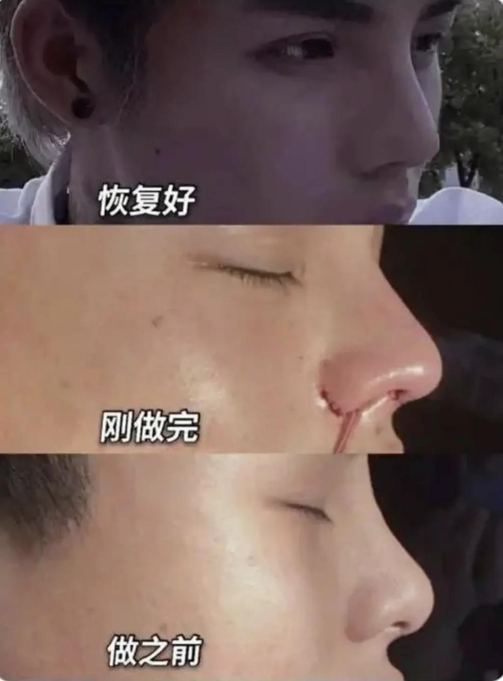 好久不见殷世航了？出国留学深造后续怎么样？