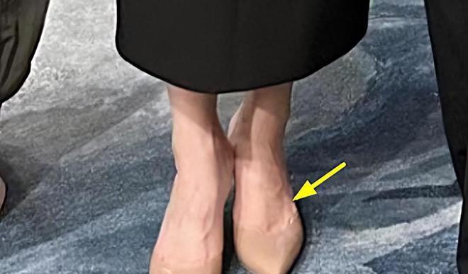 郭晶晶出席颁奖晚宴，戴5毛发圈气质出众，手背双脚令人心疼