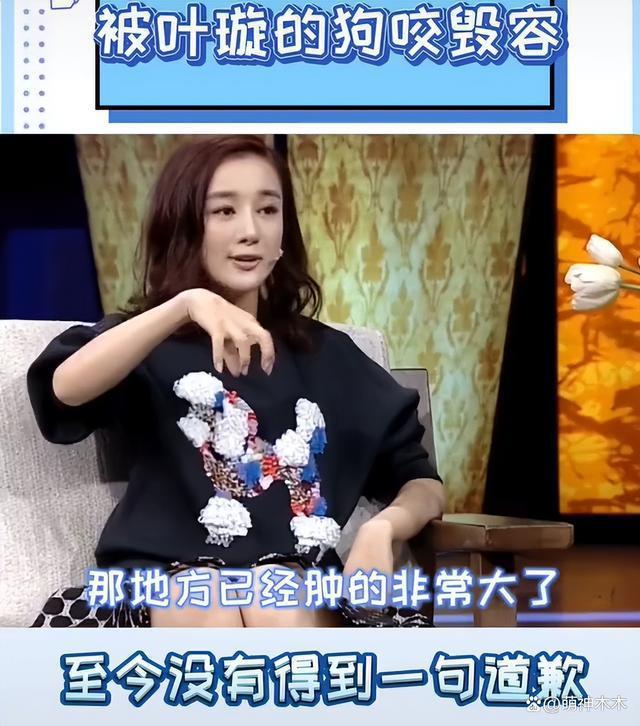 娱乐圈纵狗伤人的明星，致人毁容、害死老人，一个比一个过分