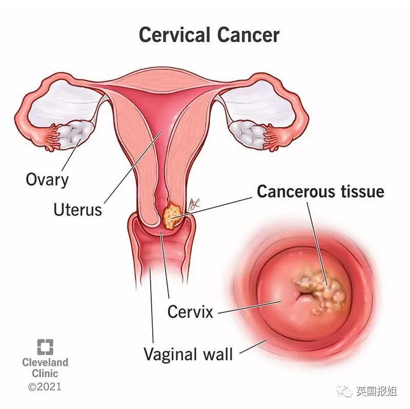 全球最美女人之一去世，年仅26岁！曾在中国参加选美比赛