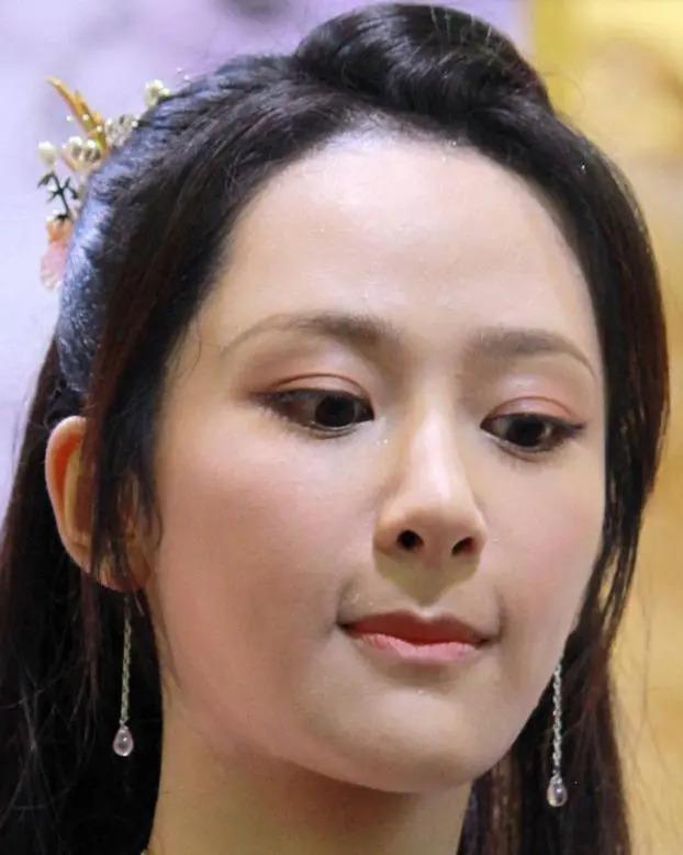 长得“歪瓜裂枣”，整得“美若天仙”，这6位都靠脸逆天改命