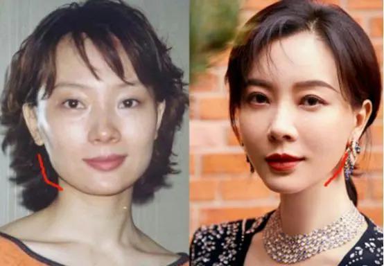 长得“歪瓜裂枣”，整得“美若天仙”，这6位都靠脸逆天改命
