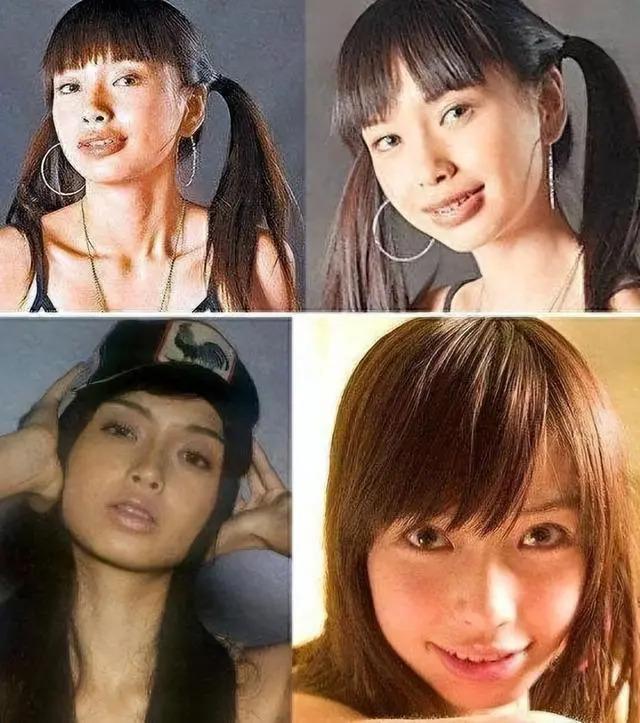 长得“歪瓜裂枣”，整得“美若天仙”，这6位都靠脸逆天改命