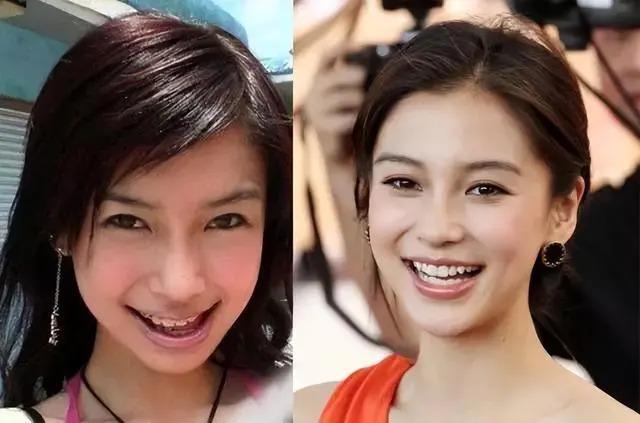长得“歪瓜裂枣”，整得“美若天仙”，这6位都靠脸逆天改命