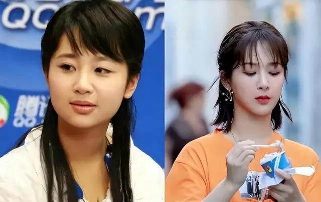 长得“歪瓜裂枣”，整得“美若天仙”，这6位都靠脸逆天改命