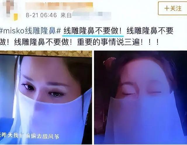 长得“歪瓜裂枣”，整得“美若天仙”，这6位都靠脸逆天改命